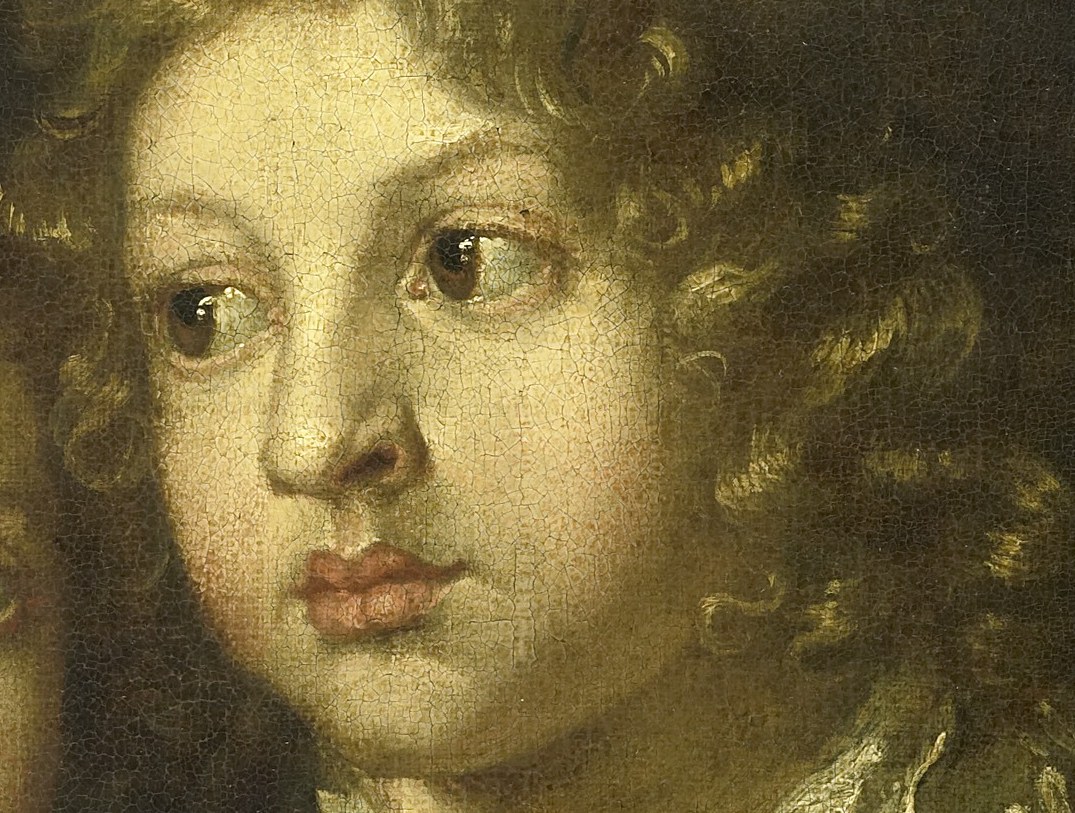 Look closely at the boy’s fine, curly hair.