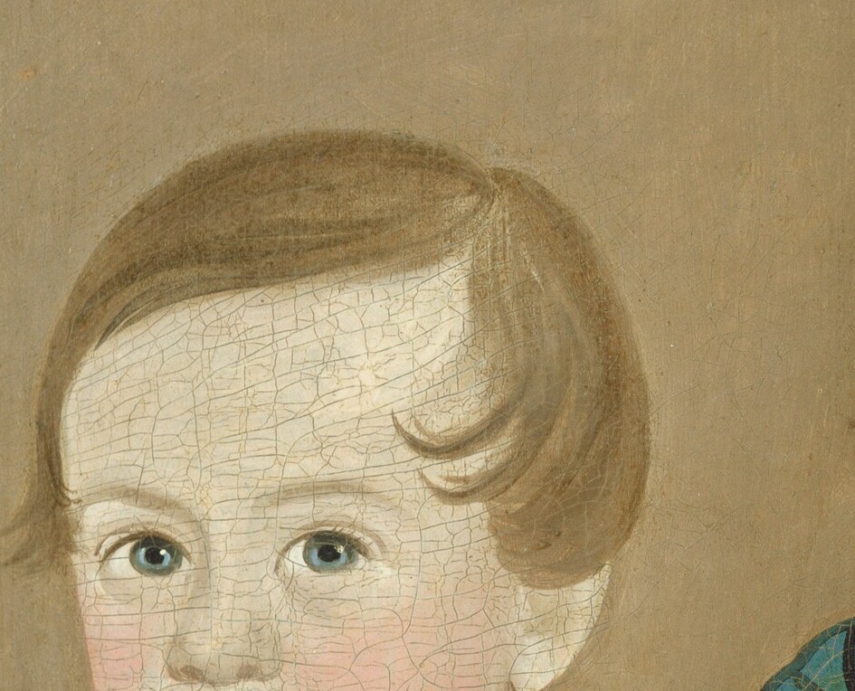 The attacker slashed the canvas across the boy's face.