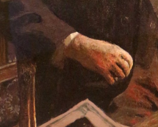 This man's hands are at rest, but alert.