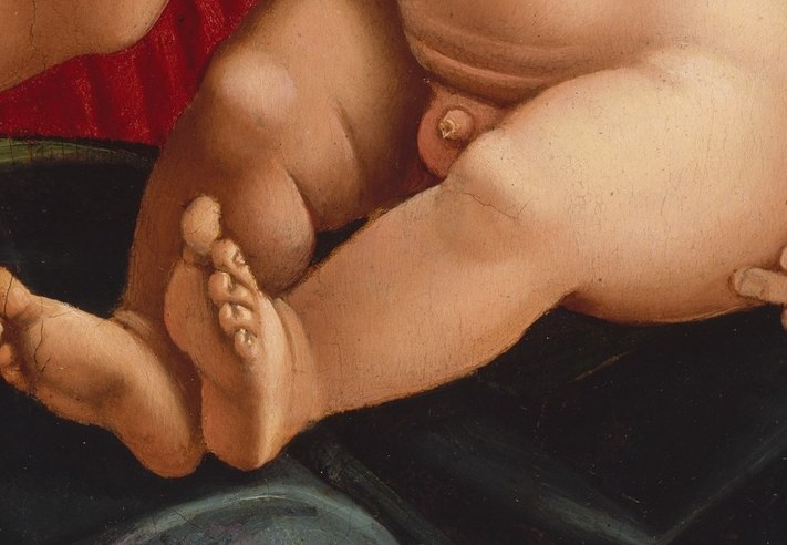 You can see it in the child's thighs and bare feet.